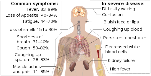 Common symptoms of COVID-19