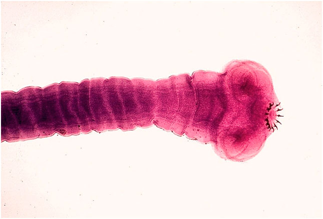 Skolex (Kopf) des Bandwurms - Taenia solium. (Credit: CDC/Dr. Mae Melvin) alt
