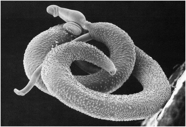 Schistosoma - von Wikipedia.org alt