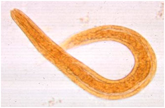 Bild von Strongyloides alt