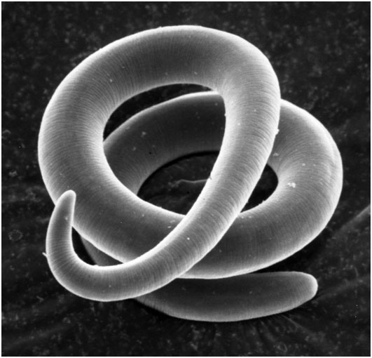 Foto von Trichinella - aufgenommen von Dickson Despommier Ph.D., Mailman School of Public Health – Columbia University – www.trichinella.org alt