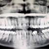 Entnommen von http://www.tapparo.com/ENG/disurbi_dente.php