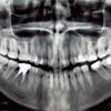 Entnommen von http://www.tapparo.com/ENG/disurbi_dente.php