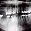 Entnommen von http://www.tapparo.com/ENG/disurbi_dente.php